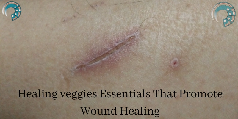 Healing veggies Essentials That Promote Wound Healing