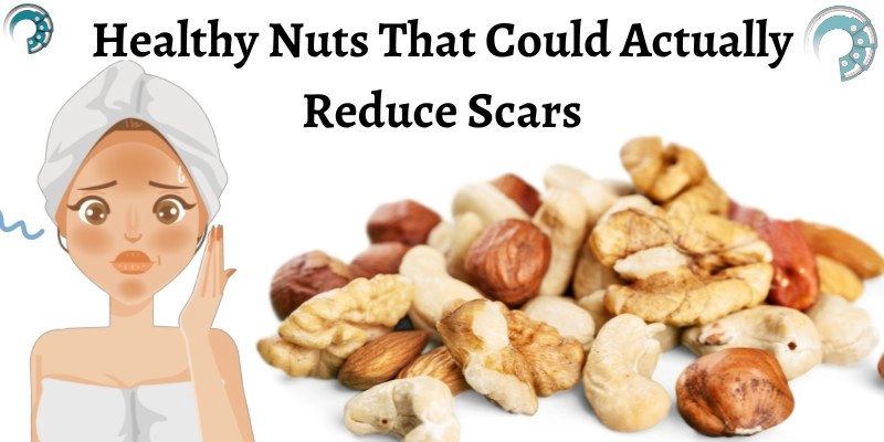 Healthy Nuts That Could Actually Reduce Scars