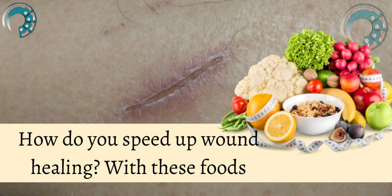 How do you speed up wound healing? With these foods