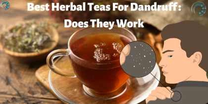 Best Herbal Teas For Dandruff : Does They Work
