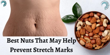 Best Nuts That May Help Prevent Stretch Marks