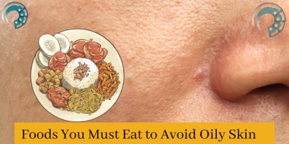 Foods You Must Eat to Avoid Oily Skin