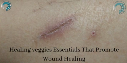 Healing veggies Essentials That Promote Wound Healing