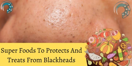 Super Foods To Protects And Treats From Blackheads